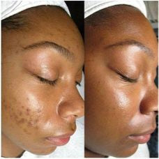 KIT HYDRATANT & CLARIFIANT