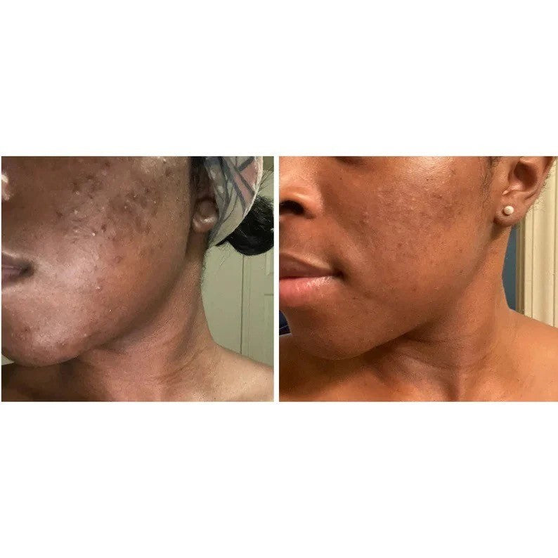 SAVON CURCUMA ET ACIDE KOJIQUE 200g