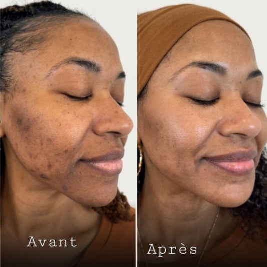 Routine Visage Glow-up