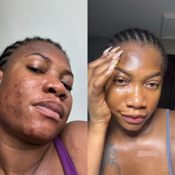 ROUTINE COMPLETE VISAGE AU CURCUMA