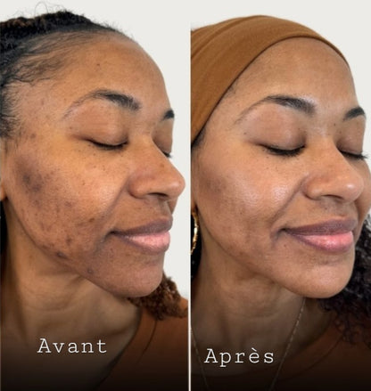 CRÈME DE VISAGE AU CURCUMA